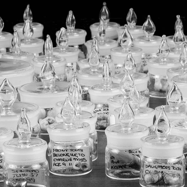 Collection of teeth in little glass pots