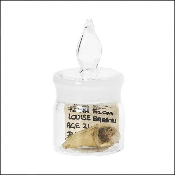 Filled tooth in glass pot - part of tooth collection