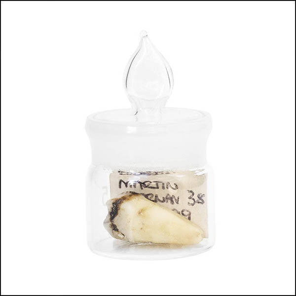 Filled tooth in glass pot - part of tooth collectionn