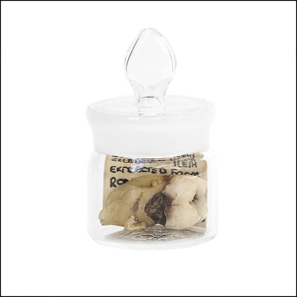 Filled Tooth in glass pot - part of tooth collection