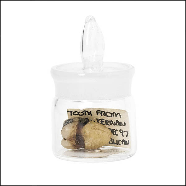 Filled tooth in glass pot - part of tooth collection