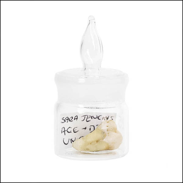 Wisdom tooth in glass pot - part of tooth collection
