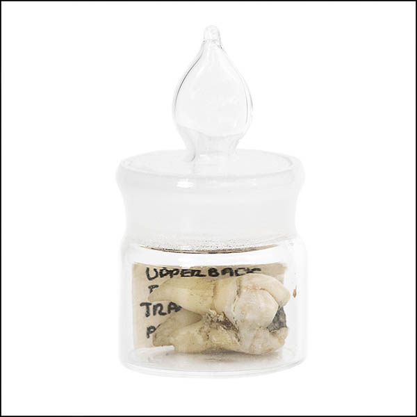Tooth in glass pot - part of tooth collection